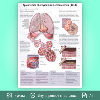 Плакат «Хроническая обструктивная болезнь легких (ХОБЛ)» (ЗОЖ-49, 1 лист, А2)